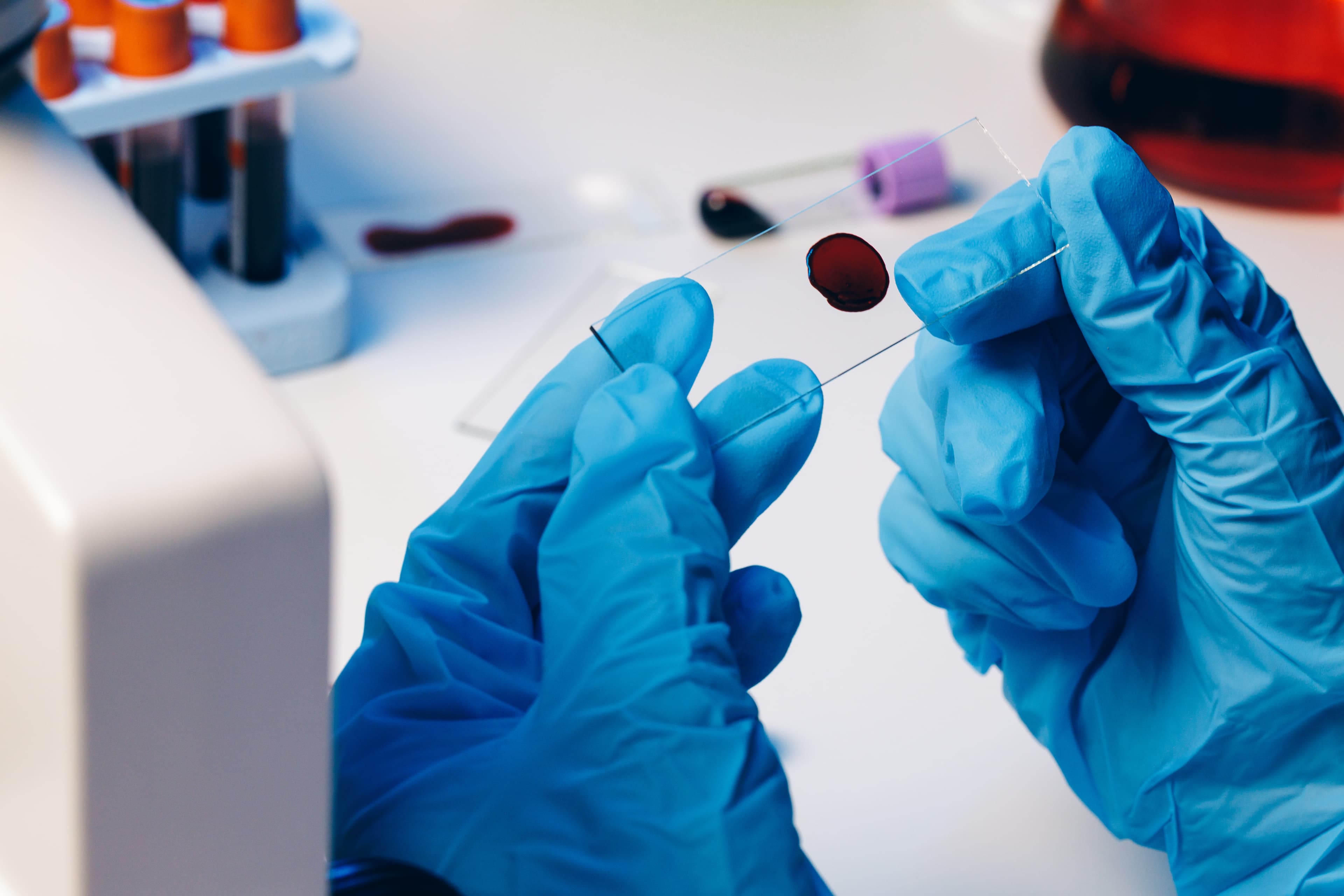 Genetic report and cheek swab kit for methylation and detox testing